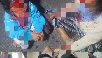 PANGKALPINANG, BANGKATERKINI   Minimnya penerangan di Jalan SMP 10, Jalan Tanjung Raya Bunga Kota Pangkalpinang,,